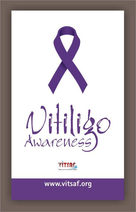 Vitiligo Support Association Graphic Vitiligo Support Association Graphic